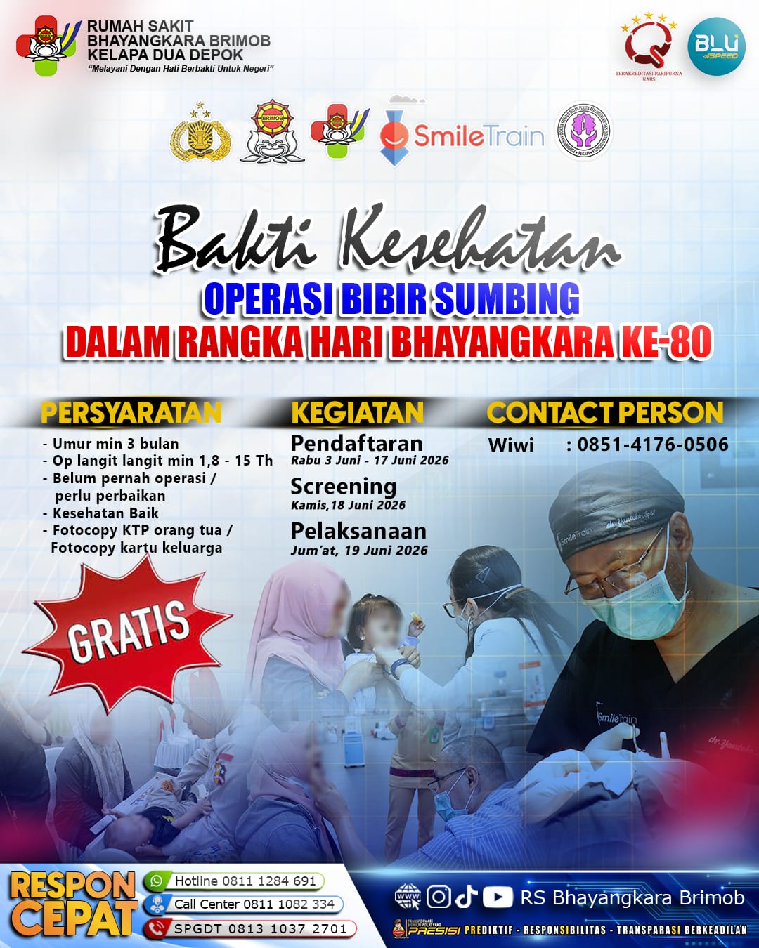 Featured image for “Sambut Hari Bhayangkara ke-80, RS Bhayangkara Kelapa Dua Gelar Operasi Bibir Sumbing Gratis”